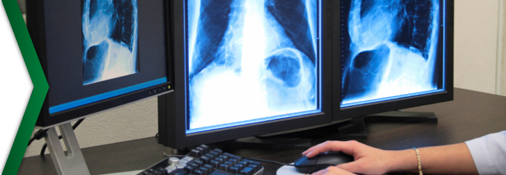Radiografias digitales